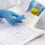 Urine Tests Importance in Kidney Disease Detection