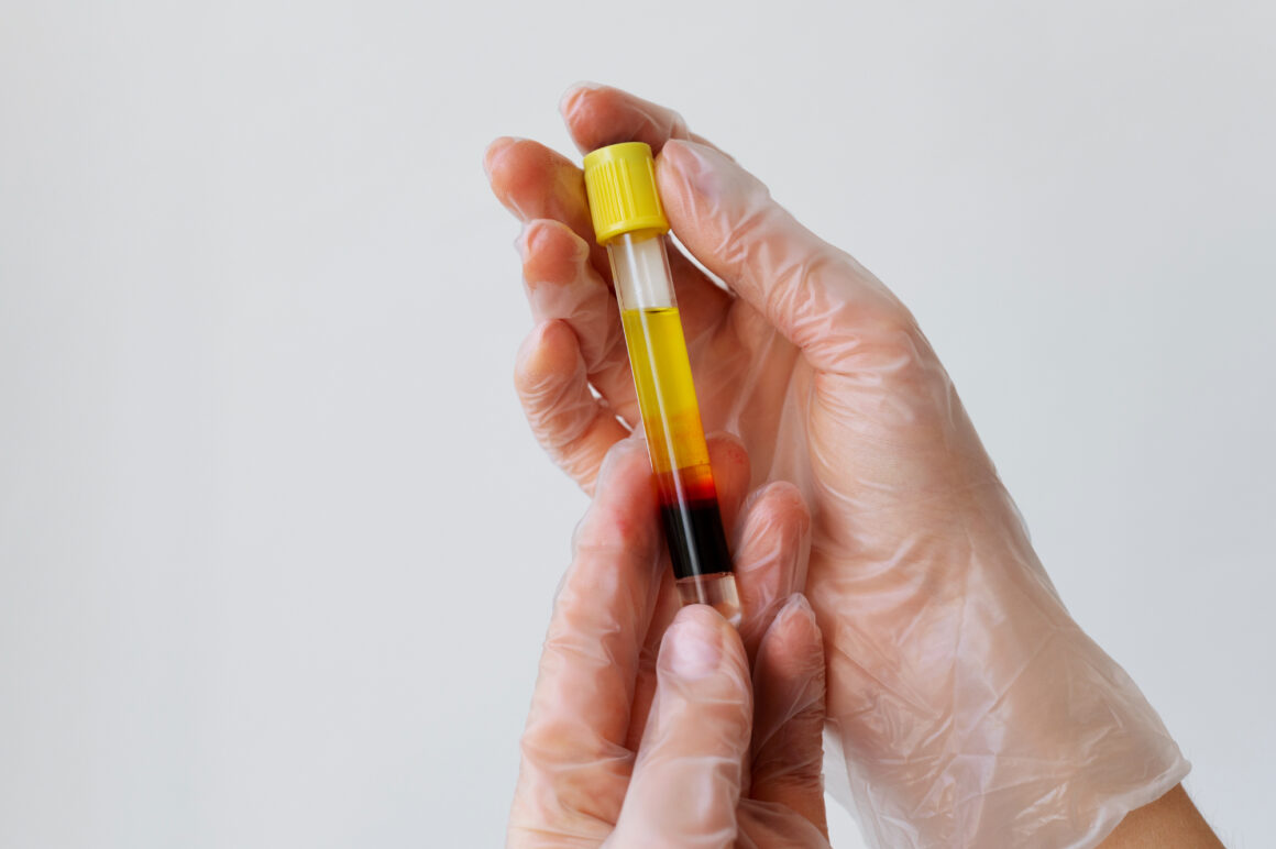 The Future of Preventive Healthcare: How Blood and Urine Tests Save Lives