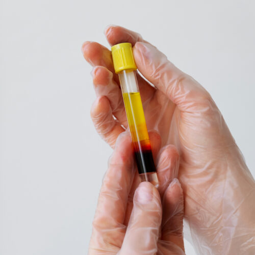 The Future of Preventive Healthcare: How Blood and Urine Tests Save Lives